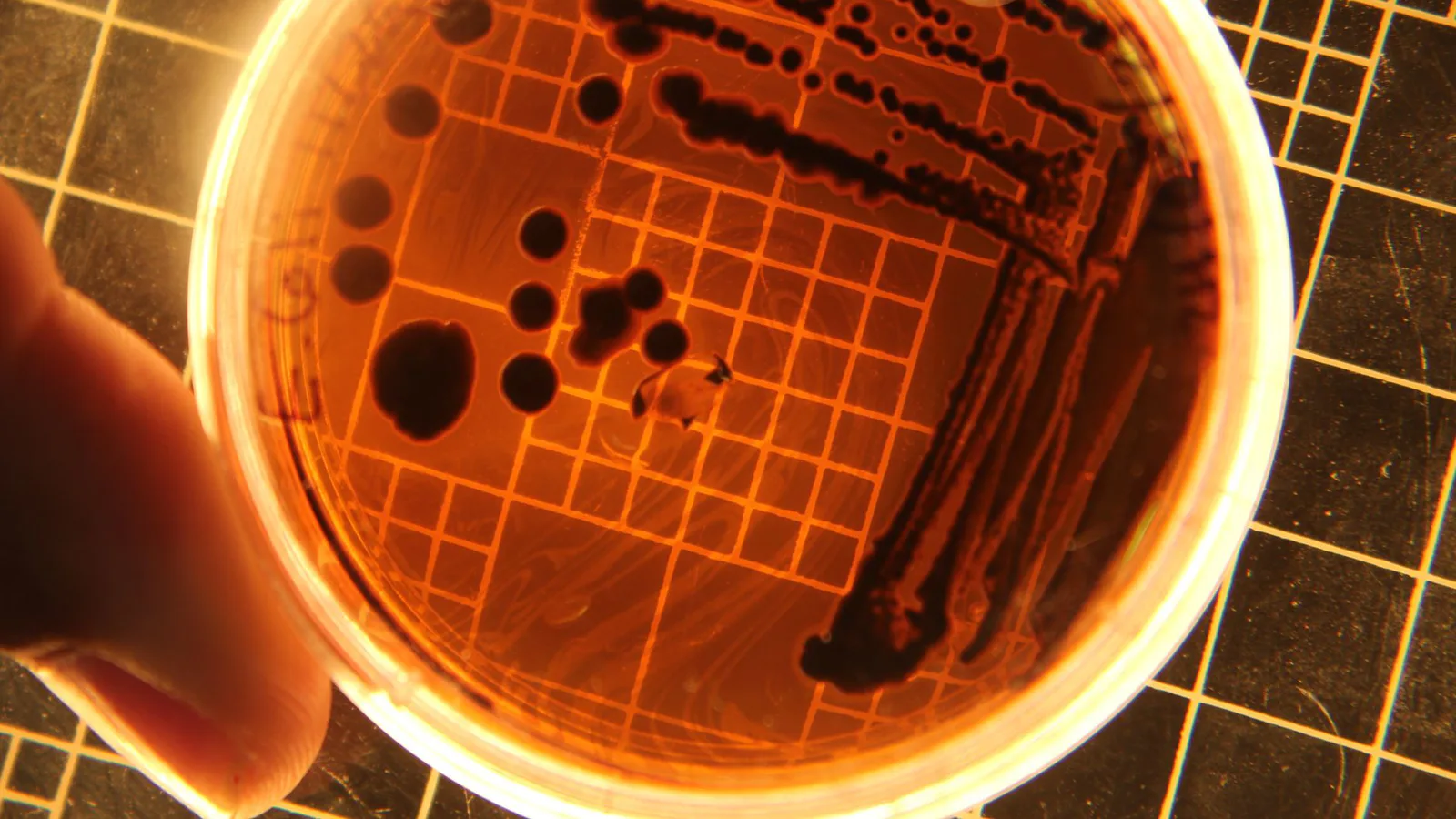 detección de salmonella en Salmonella en alimentos: cómo se detecta y quién responde legalmente